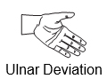 Wrist Ulnar Deviation