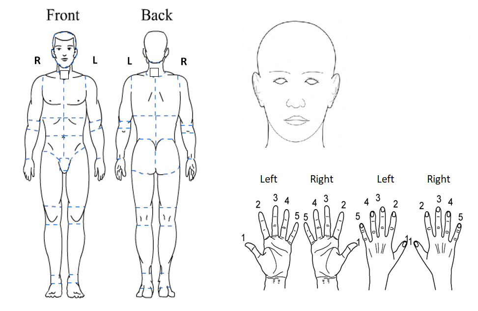 Injury Location